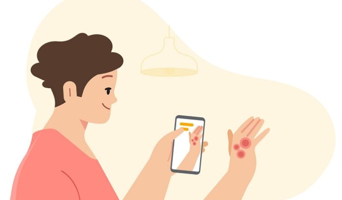 Google launches AI health tool for skin conditions