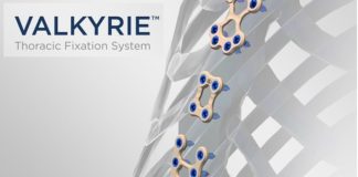 Able Medical Announces First Surgeries and Launch of the Valkyrie Thoracic Fixation System