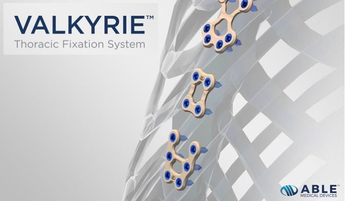 Able Medical Announces First Surgeries and Launch of the Valkyrie Thoracic Fixation System