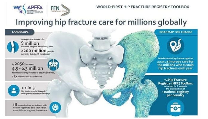 World-first Hip Fracture Registry Toolbox 