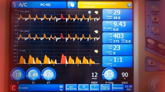 An Easy Guide To Understanding How Patient Monitors Work