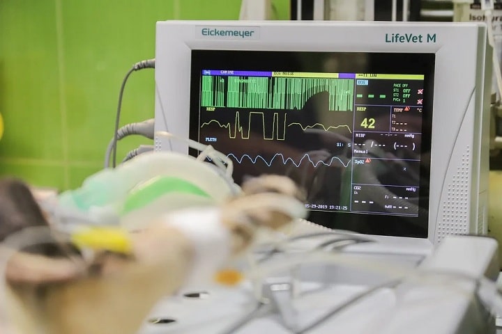 An Easy Guide To Understanding How Patient Monitors Work