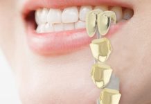 Are grills safe for your teeth?