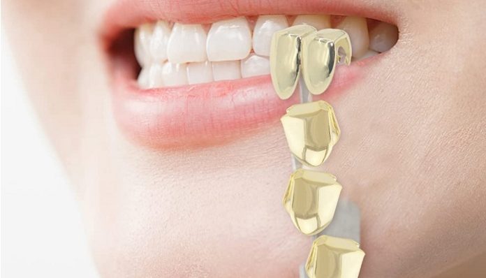 Are grills safe for your teeth?