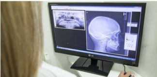 Canon Medical Systems acquires Danish medical equipment manufacturer Nordisk Rontgen Teknik to strengthen its global X-ray business