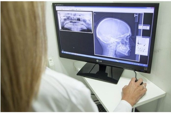 Canon Medical Systems acquires Danish medical equipment manufacturer Nordisk Rontgen Teknik to strengthen its global X-ray business