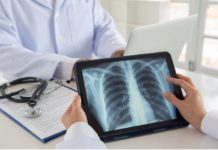 Revolutionary Lung Cancer Drug Sotorasib Launched By NHS