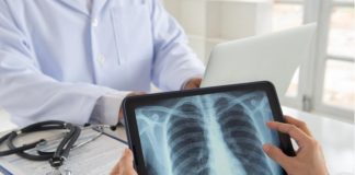 Revolutionary Lung Cancer Drug Sotorasib Launched By NHS