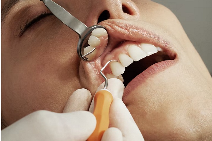 A Helpful Guide to Root Canal Treatment
