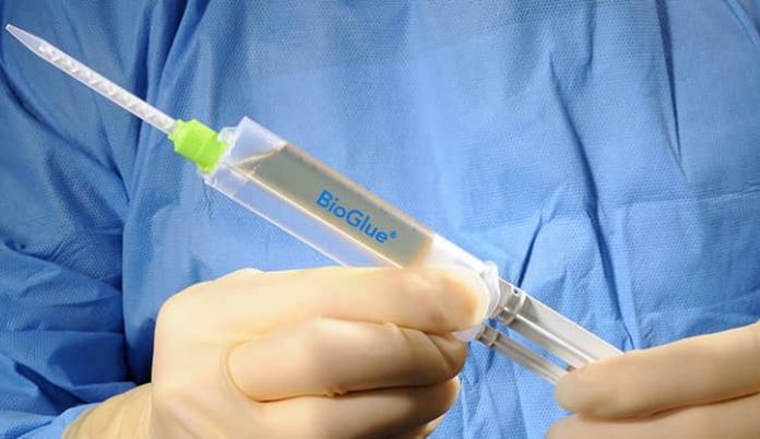 Bio-Glue Surgical Sutures Obsolete