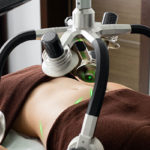 Important Things To Know Before Undergoing Liposuction Procedure