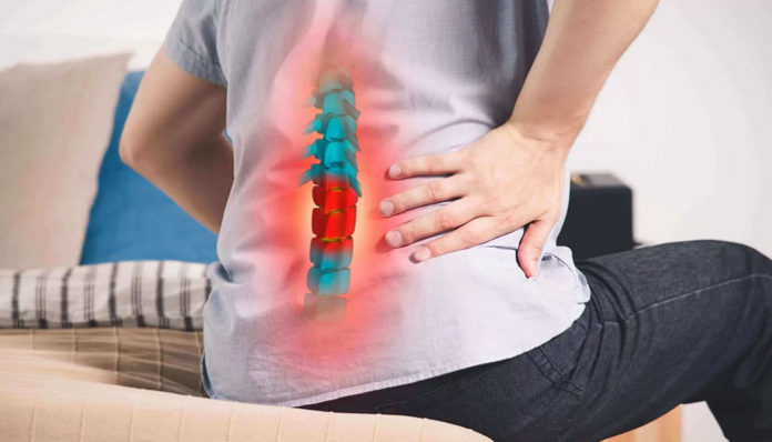 Herniated Disc: Common Causes and When to Seek Legal Help