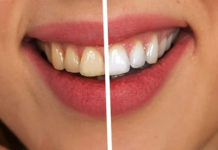 Latest Dentistry Trends: 6 Ways To Achieve A Shiny Smile