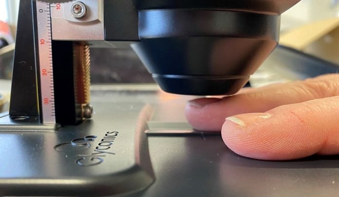 New fingernail scanning device reveals likelihood of type 2 diabetes in seconds
