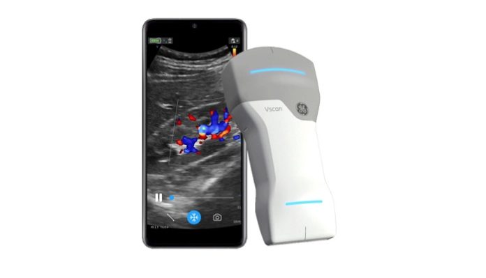 GE HealthCare Launches New Handheld Ultrasound Device at ESC Congress