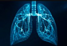 AstraZeneca and Institut Kanser Negara Partner for AI Lung Screening