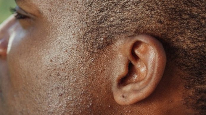 What Causes Hearing Loss? 12 Common and Less Common Causes