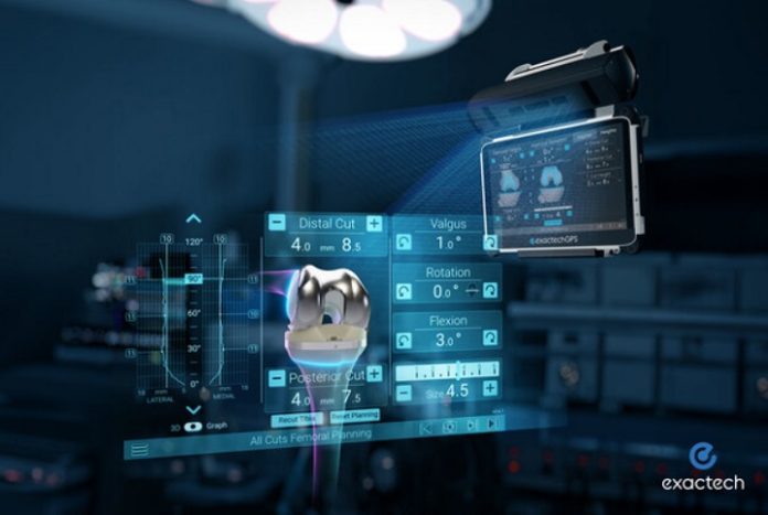 Exactech launches new knee replacement software ExactechGPS