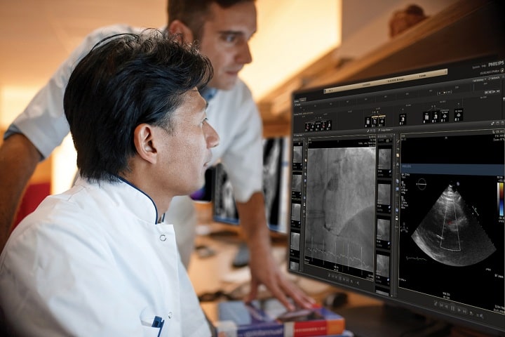 Philips debuts innovations in ultrasound and enterprise informatics to advance cardiac care at ESC 2019