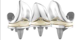 DePuy Synthes Expands ATTUNE Knee Platform with Cementless Option