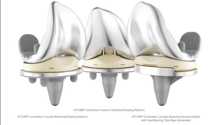 DePuy Synthes Expands ATTUNE Knee Platform with Cementless Option