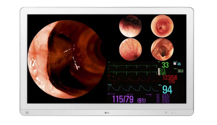 LG Introduces Enhanced Display Devices for Medical Environments