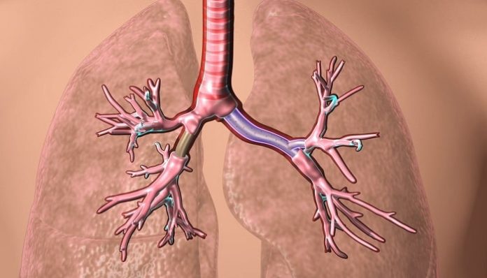 FDA Approves 3D-printed Airway Stents Developed by Cleveland Clinic Doctor