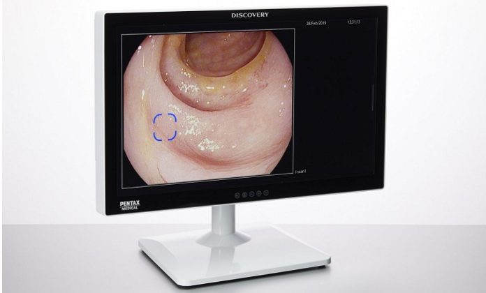 HOYA Group PENTAX Medical Cleared CE Mark for DISCOVERY, an AI Assisted Polyp Detector