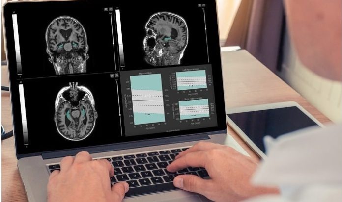 Qynapse receives FDA clearance for QyScore , a novel imaging software for central nervous system diseases Qynapse receives FDA clearance for QyScore , a novel imaging software for central nervous system diseases