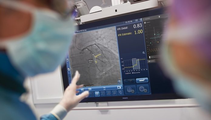 Philips to study outcomes of PCI guided by iFR and X-ray images