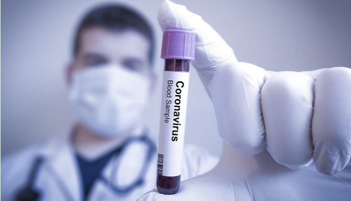 Synergy Laboratories Adds Medical Testing Expertise to Fight the Coronavirus and COVID-19
