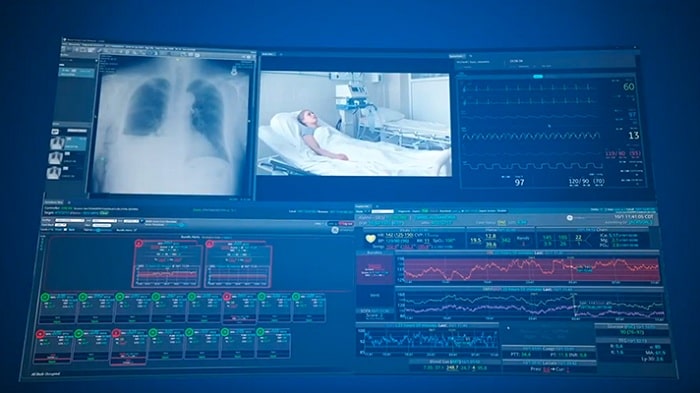 GE Healthcare Deploys Remote Patient Data Monitoring Technology  