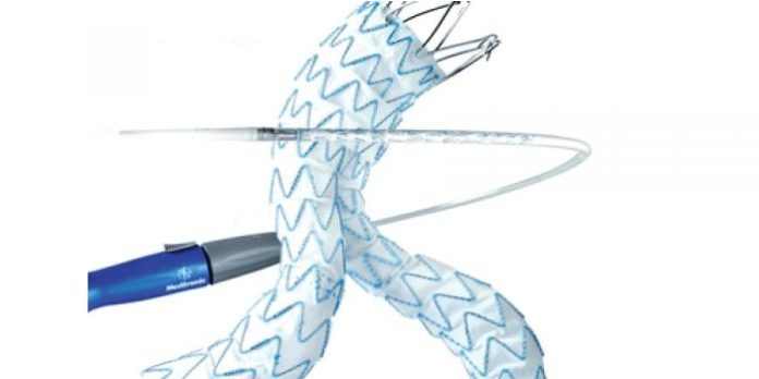 FDA Grants NEXUS Aortic Arch Stent Graft System Breakthrough Designation