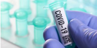 Todos Medical Announces First Commercial Sale of COVID-19 Antibody Tests
