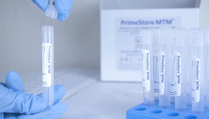 EKF secures COVID-19 novel sample collection kit manufacturing and supply contracts