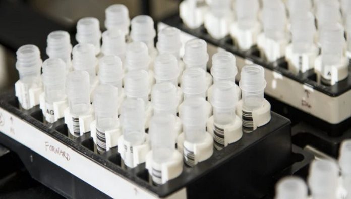 COVID-19 testing portfolio to include both antigen and antibody testing kits