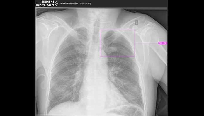 Siemens Healthineers further expanding AI portfolio in the field of clinical decision-making