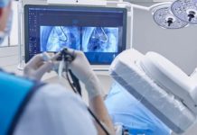  Philips paves the way for faster lung cancer diagnosis and treatment with advanced 3D imaging and navigation platform