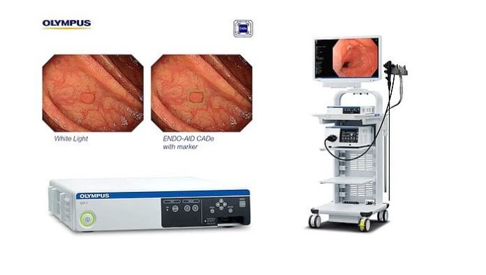 Olympus Launches ENDO-AID, an AI-Powered Platform for Its Endoscopy System