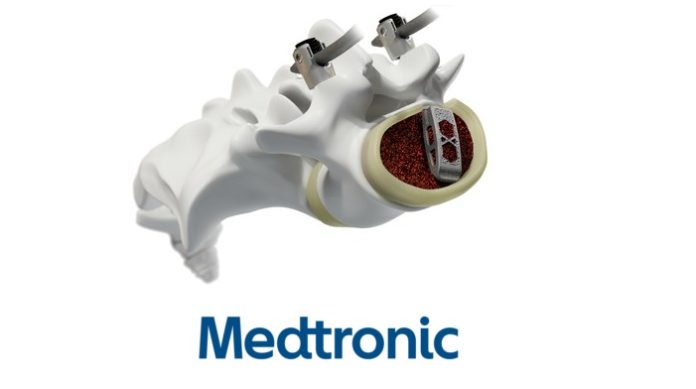 Medtronic Announces Adaptix Interbody System, the First Navigated Titanium Cage with Titan nanoLOCK Surface Technology