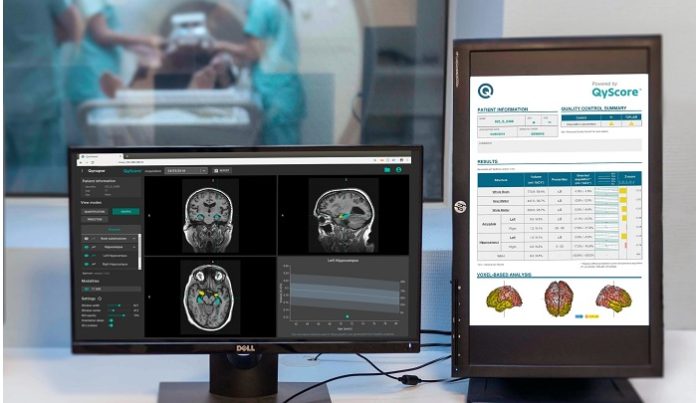 Acquisition to provide the most advanced AI platform for brain diseases