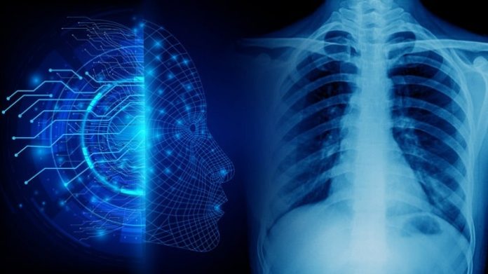 GE Healthcare Announces First X-ray AI to Help Assess Endotracheal Tube Placement for COVID-19 Patients
