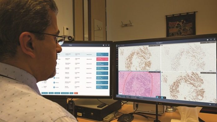 Philips boosts digital pathology with enhanced informatics to advance precision diagnosis in oncology