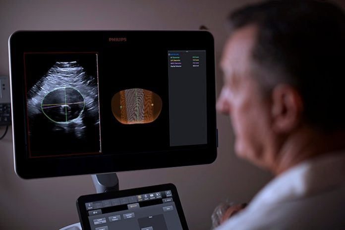 Philips integrates 3D ultrasound with innovative software for breakthrough in surveillance of abdominal aortic aneurysms
