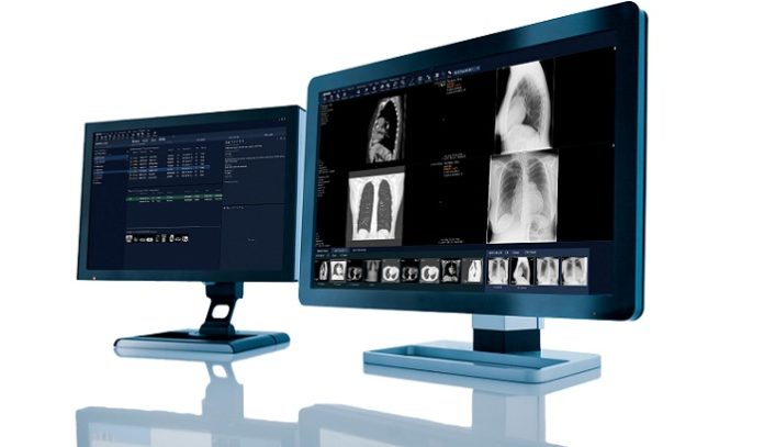 UNC Health in the US consolidates its radiology imaging with Sectra