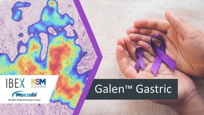 Ibex Introduces Galen Gastric, World's First AI-powered Solution for Gastrointestinal Cancer Diagnostics