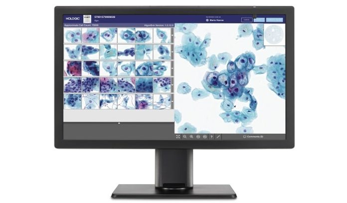 Hologic Announces European Launch of Genius Digital Diagnostics System for Cervical Cancer Screening