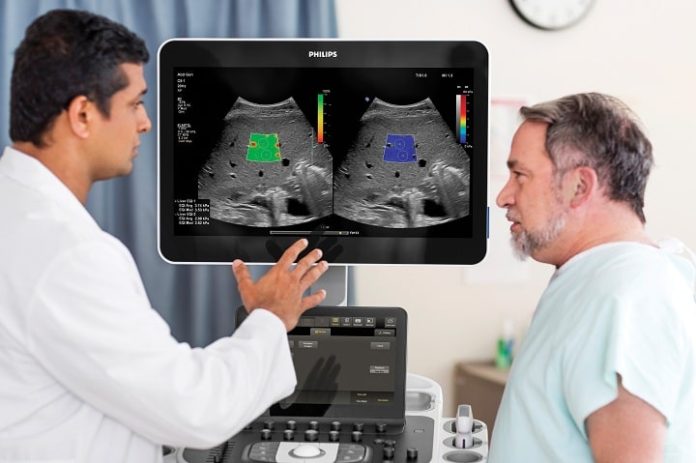 Philips advances ultrasound portfolio with new robust imaging tools and features for Radiology to increase diagnostic confidence and workflow efficiency
