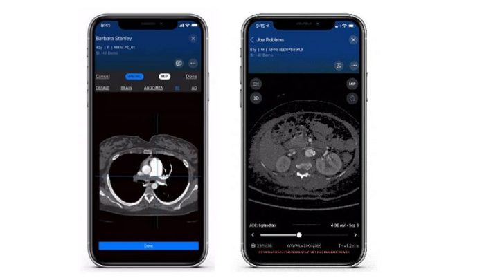 Viz.ai Launches Two New AI-Powered Modules for Pulmonary Embolism and Aortic Disease
