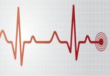Spacelabs Healthcare Introduces CardioPulse ECG Solutions for a Faster Path to Patient Care